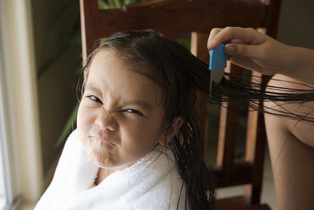 WHY YOU CAN'T GET RID OF LICE WHEN YOU HAVE TRIED EVERYTHING? LiceDoctors